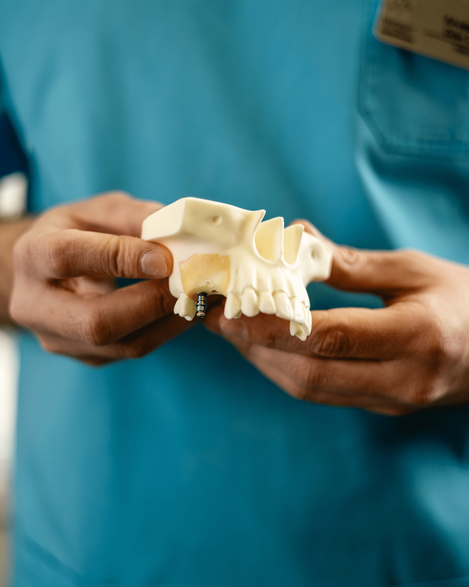 implant2