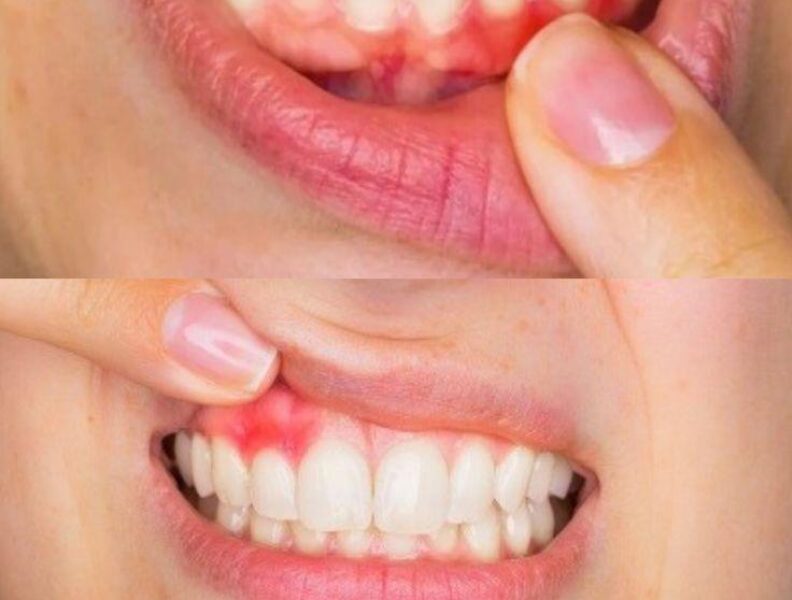 zahvoruvannya-yasen3