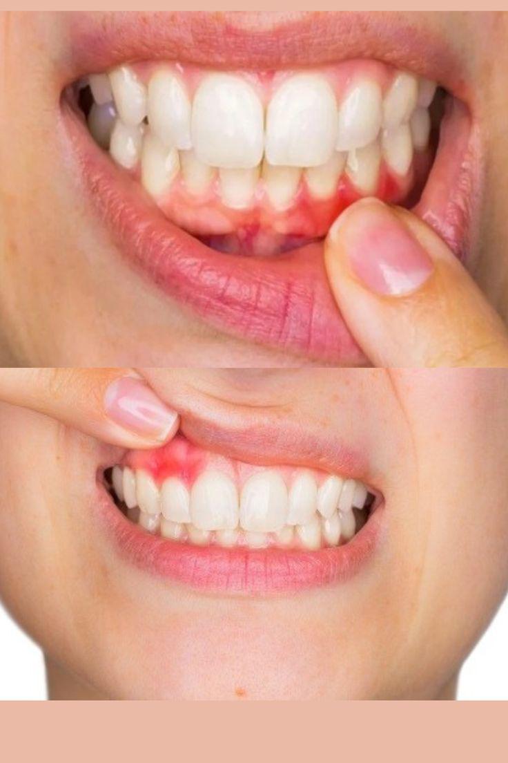 zahvoruvannya-yasen3